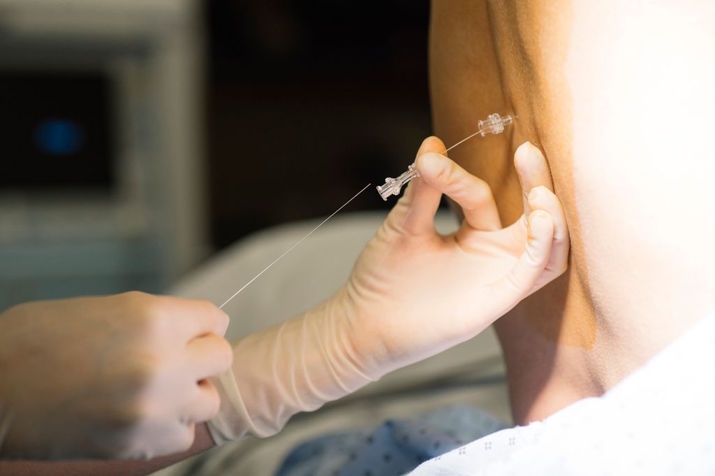 Epidural