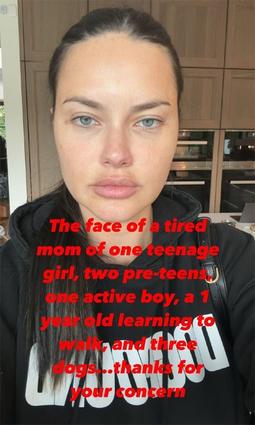 Adriana Lima responde a los comentarios que ha recibido por su cara