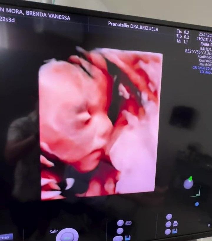 Ferdinando y Brenda mostraron las imágenes 3D de ultrasonido de su bebé en camino.