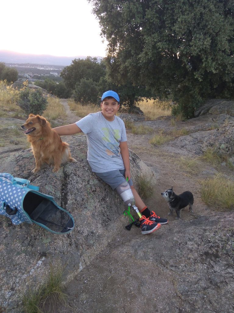 Jony Carretero en el campo tras la amputación con su prótesis