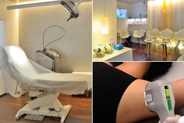 MiraDry es un sistema de microondas que destruye sin cirugía las glándulas del sudor de forma permanente
