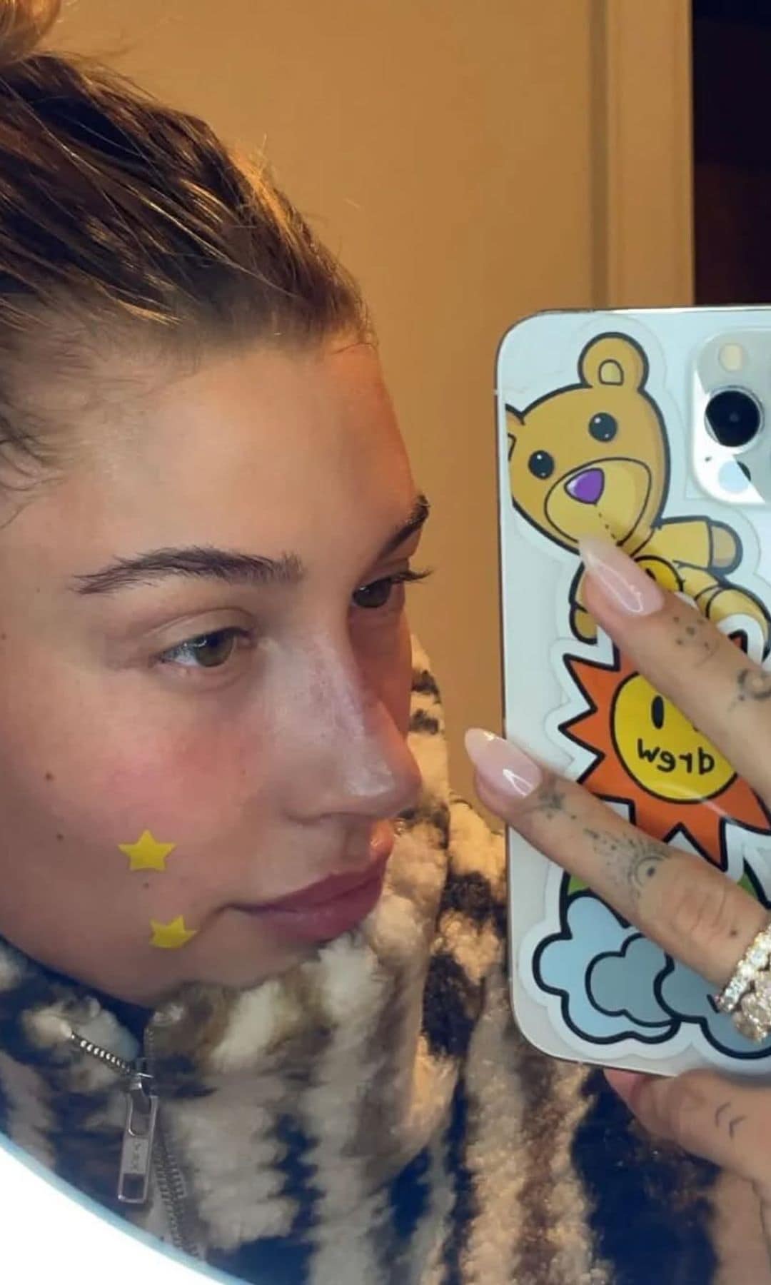 Hailey Bieber con los mejores parches para granos