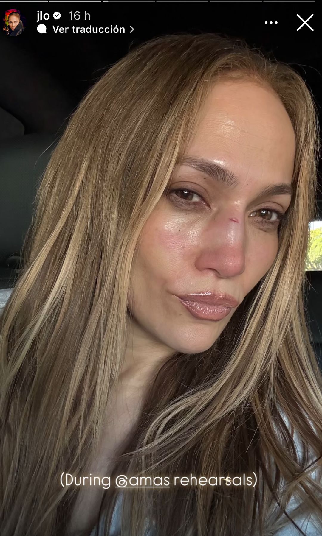 Jennifer Lopez said that the incident occurred in the trials of the American Music Awards.