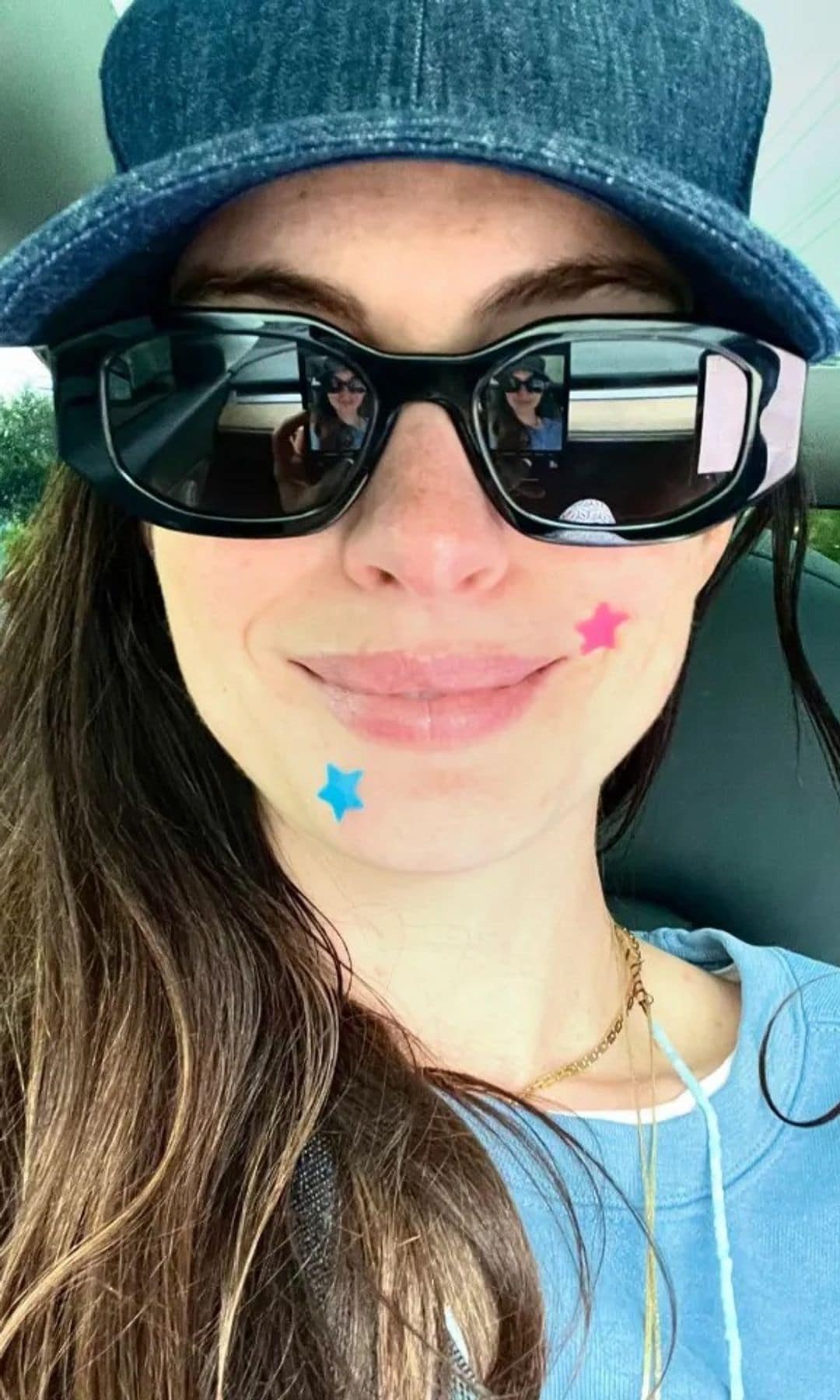 Anne Hathaway con los mejores parches para granos