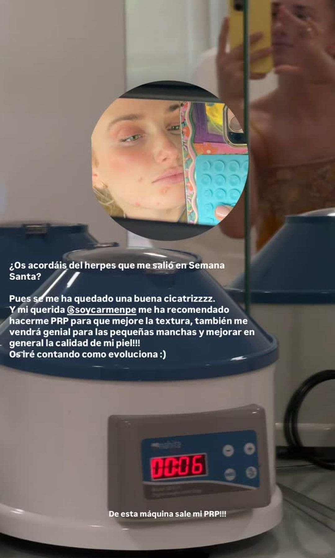 Fuen Albadalejo