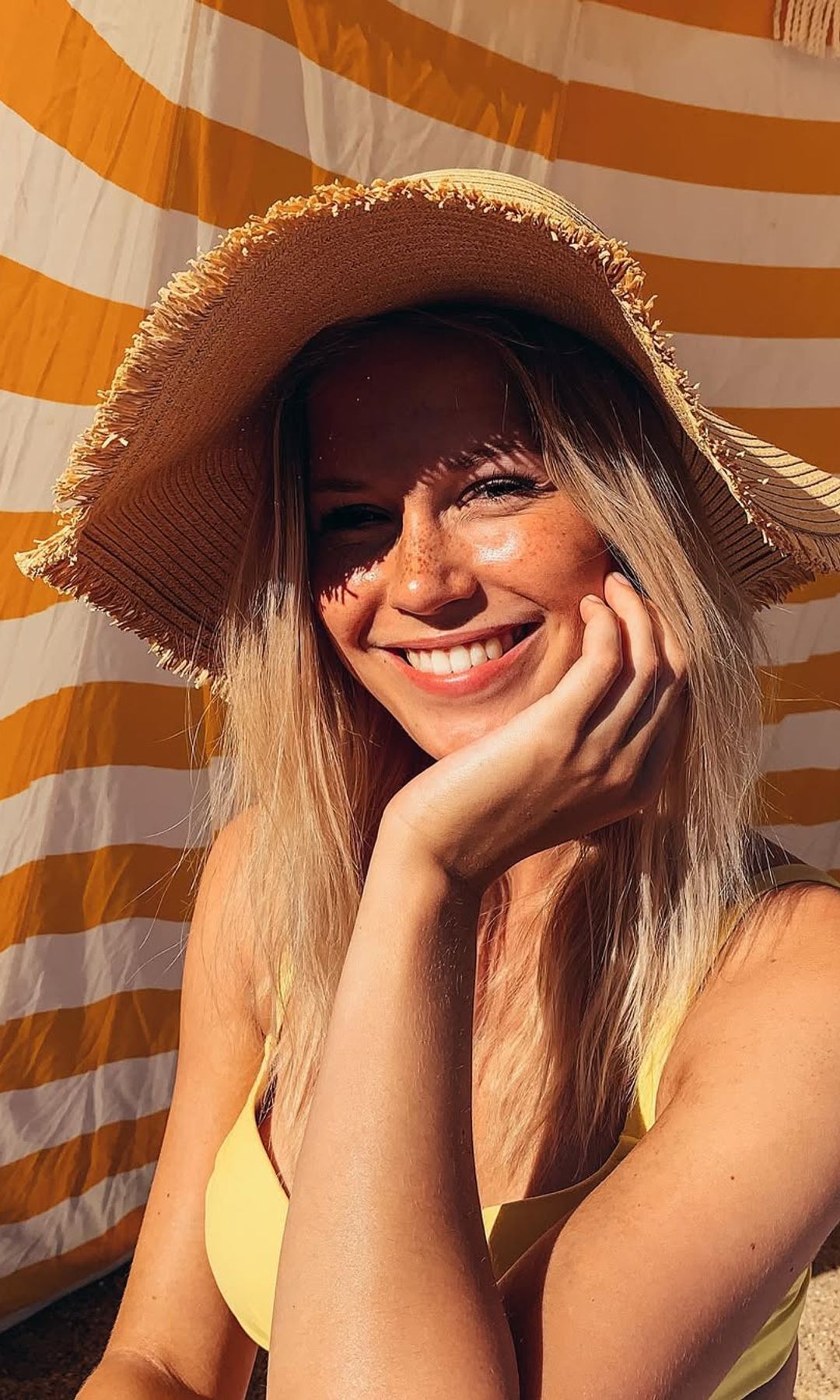 Cuidado de la piel en verano y uso de retinoles
