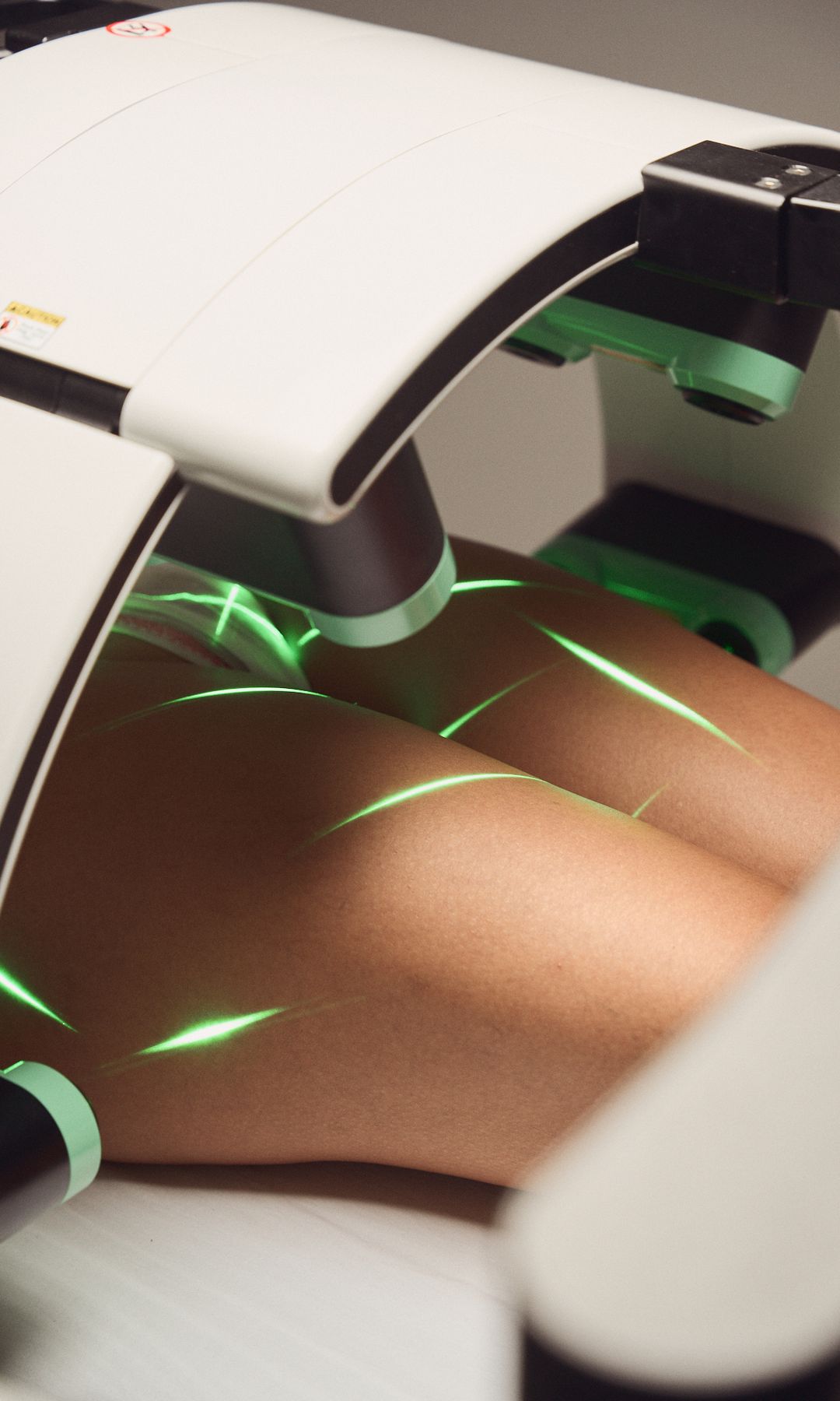 Funcionamiento del Emerald Laser
