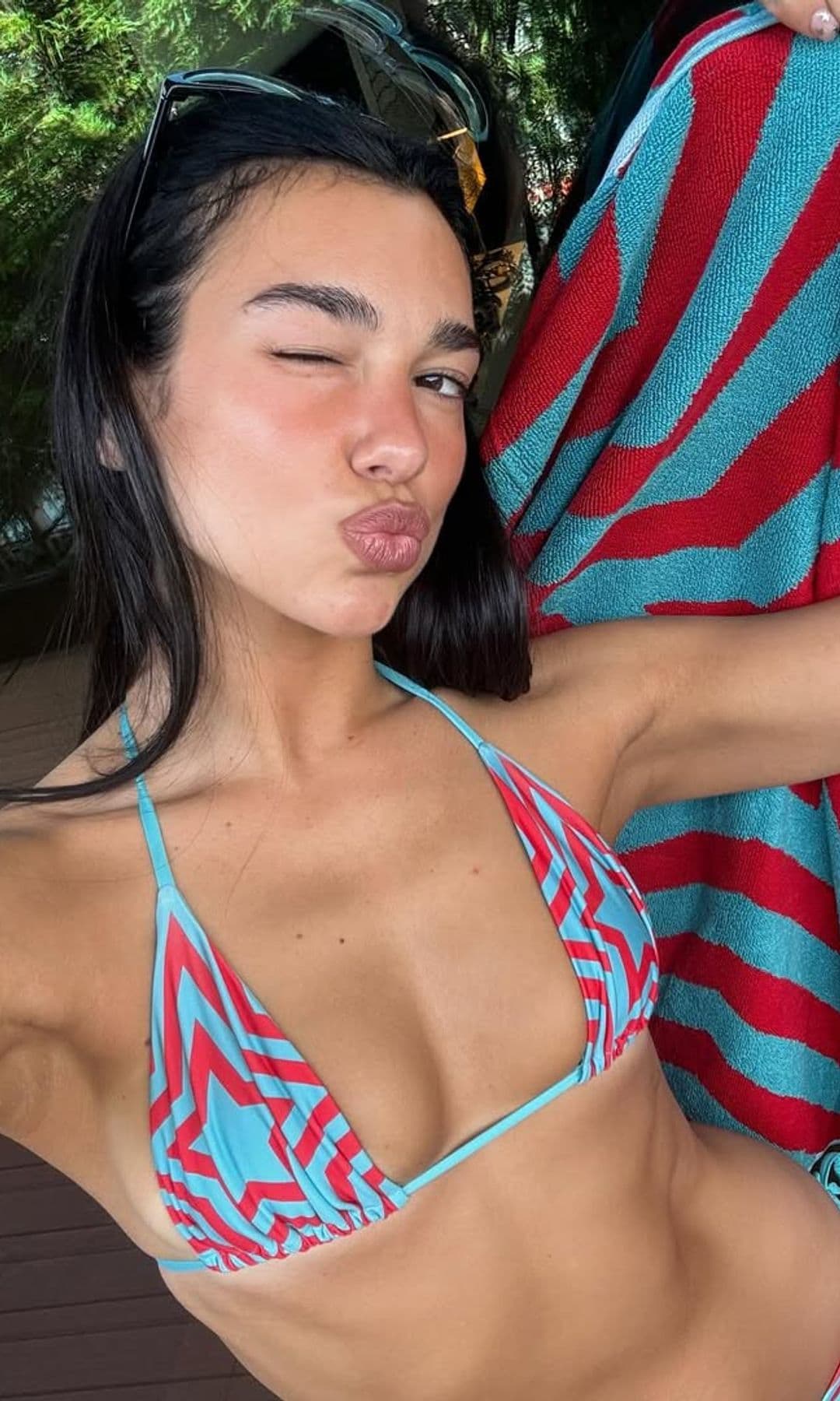 Dua Lipa medicina estética aumento de labios
