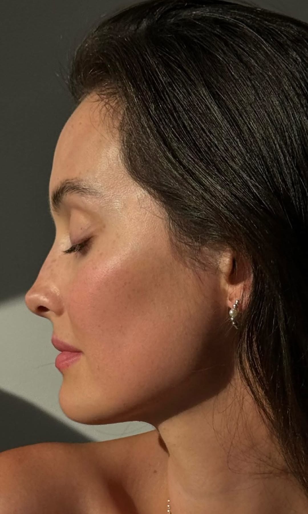 Mejores tratamientos de belleza para eliminar las manchas