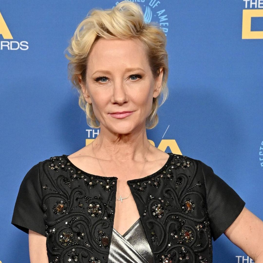 Anne Heche en condición crítica; aseguran que no sobrevivirá