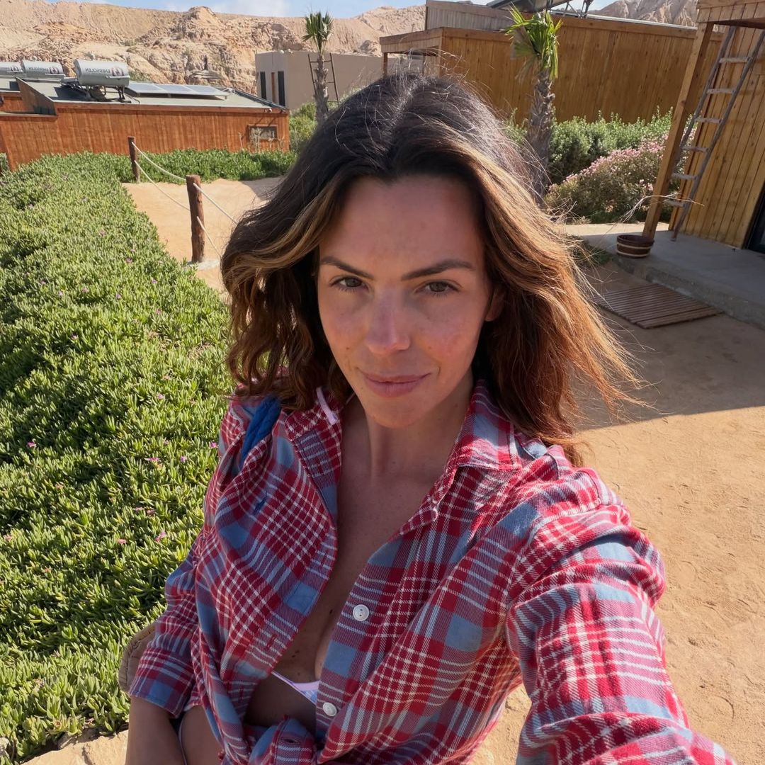 Laura Matamoros aclara el motivo de su hinchazón en la cara y tiene que ver con un tratamiento estético
