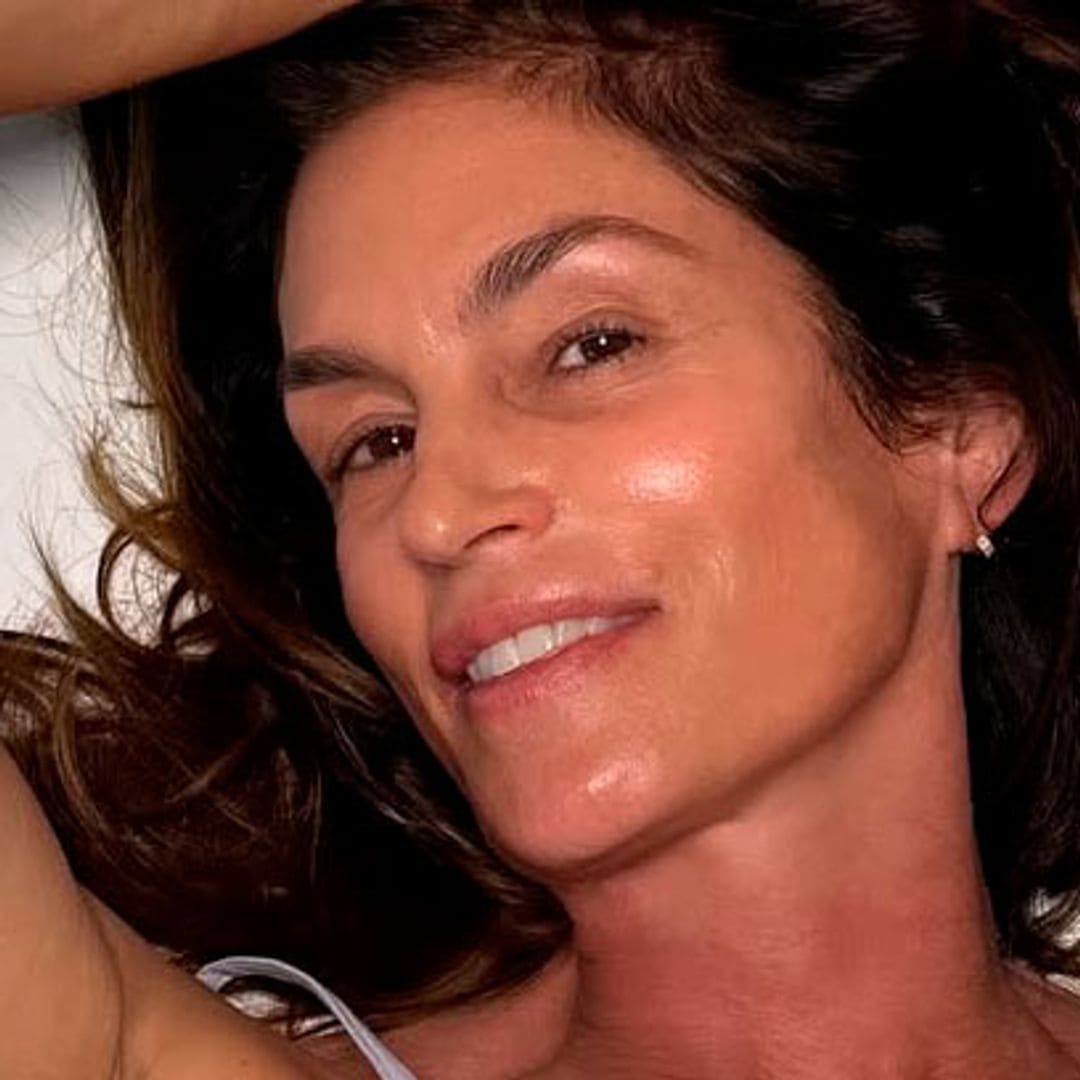 Dra. Moss, experta en medicina estética: "El contorno de ojos y el cuello son las zonas donde vemos cambios más bonitos con polinucleótidos"