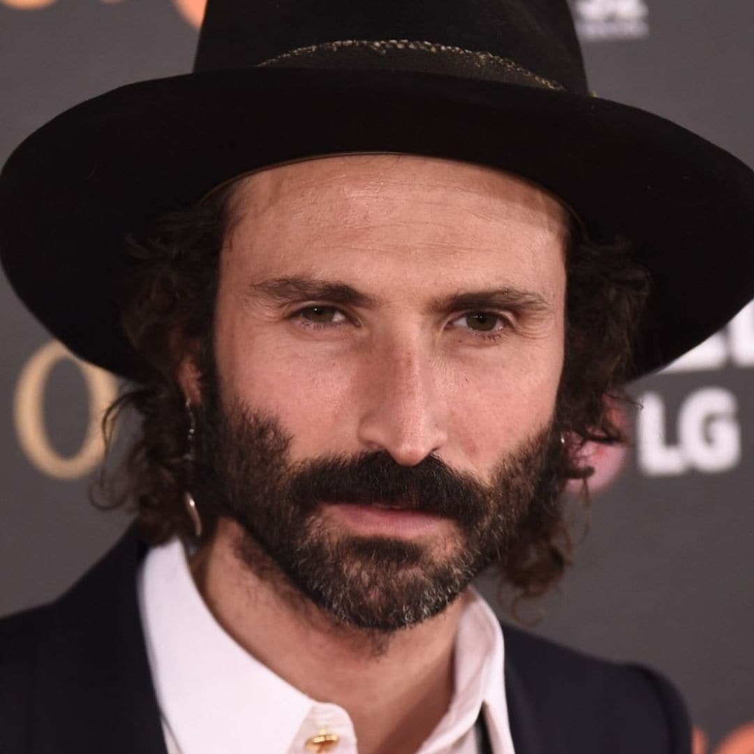 Leiva cuenta cómo fue el accidente en el que perdió la visión total de un ojo