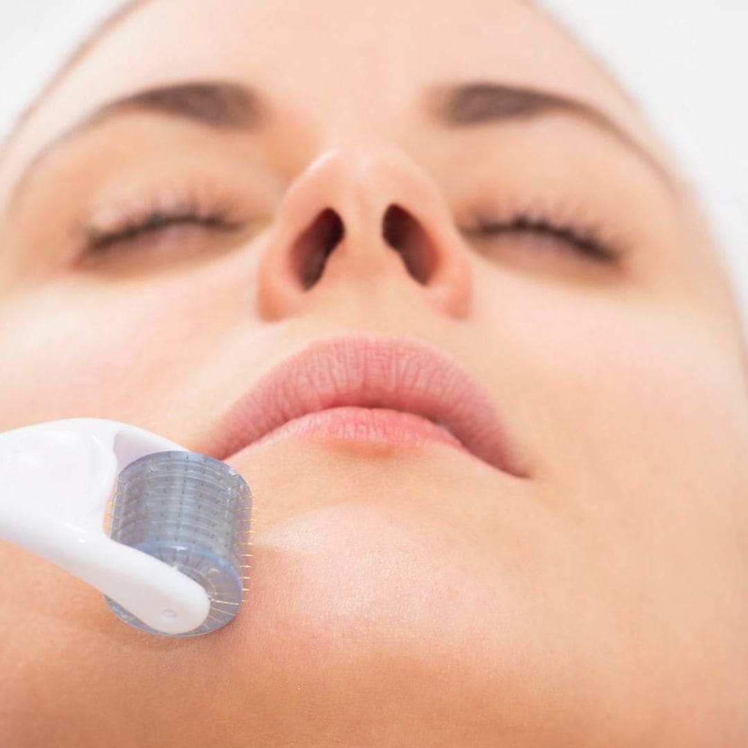 Microneedling, el tratamiento que está de moda entre las celebs