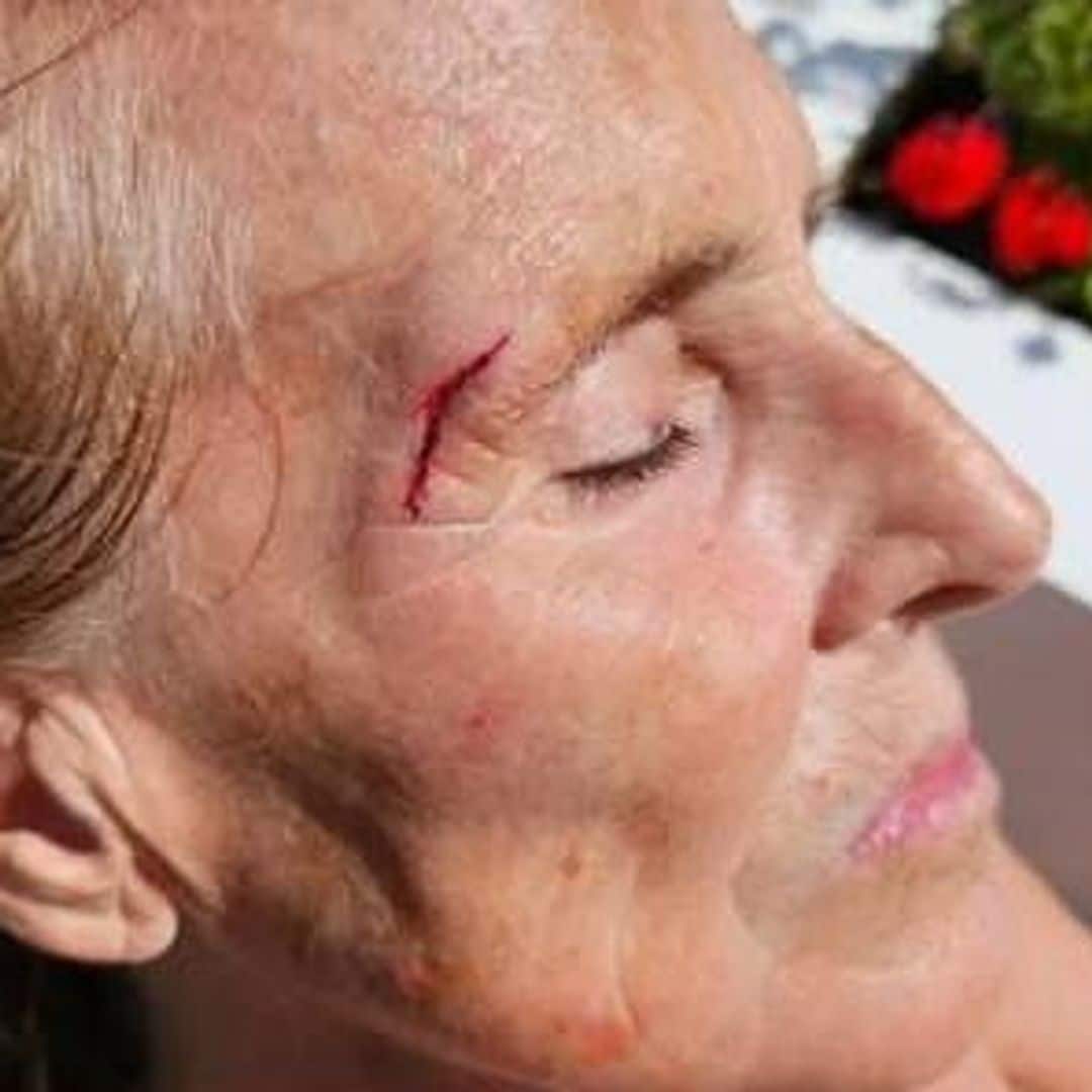 El susto de Mercedes Milá en su propia casa: "Me he caído en el patio"