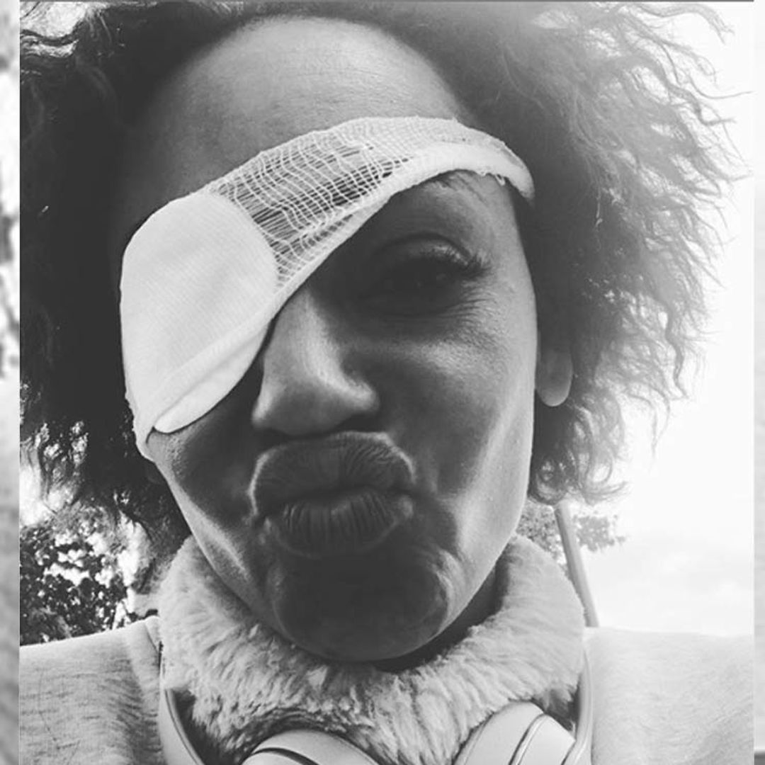 ¿Qué le ha pasado a Mel B en el ojo?