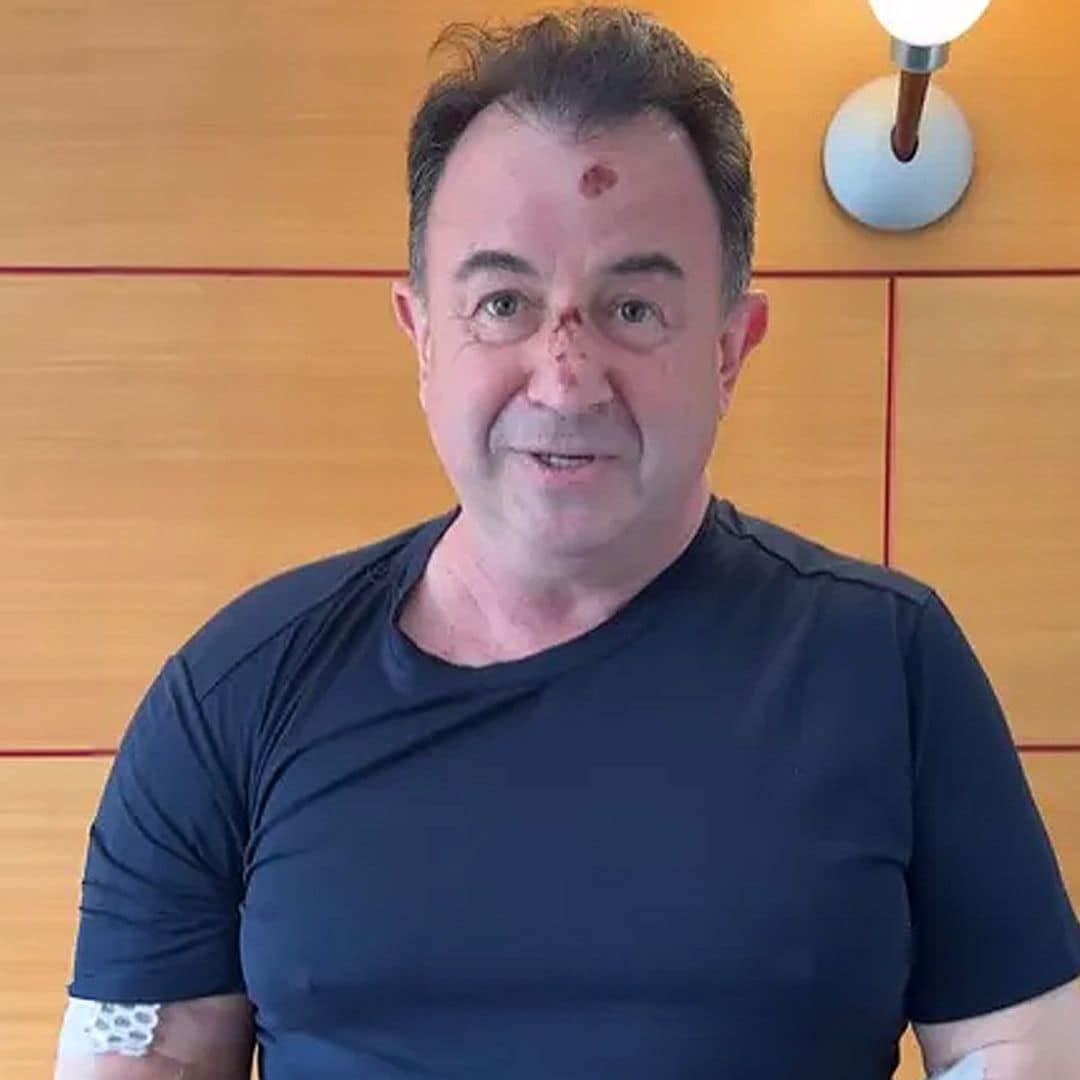 Martín Berasategui, operado tras sufrir una aparatosa caída y fracturarse el húmero 'por todos los lados'