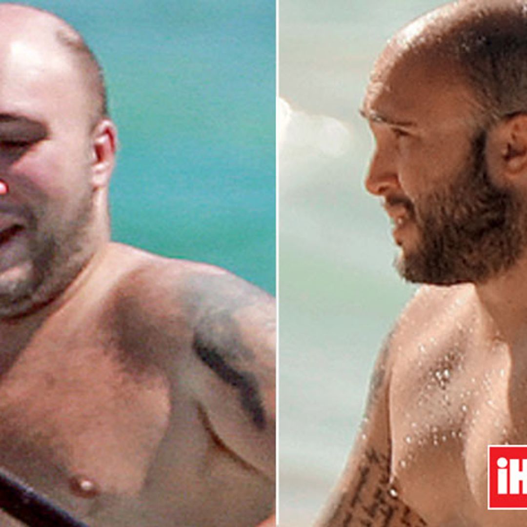 En ¡HOLA! Kiko Rivera, antes y después de su operación