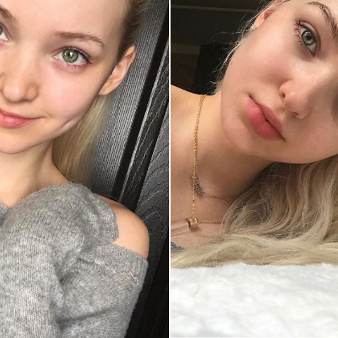 Dove Cameron sin maquillaje: consejos para tener una piel perfecta