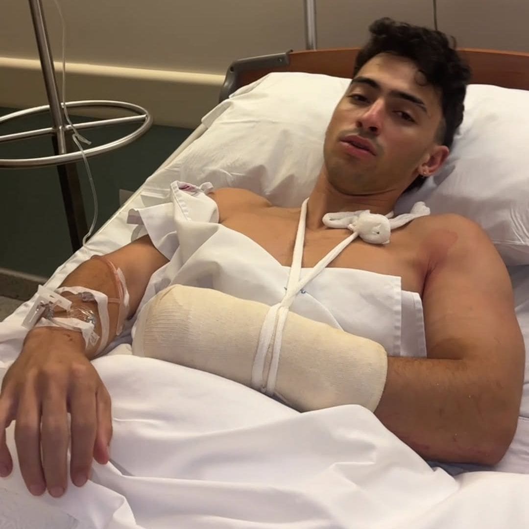 Gero Arias, el influencer de las 366 dominadas, sufre una caída y pierde dos dedos