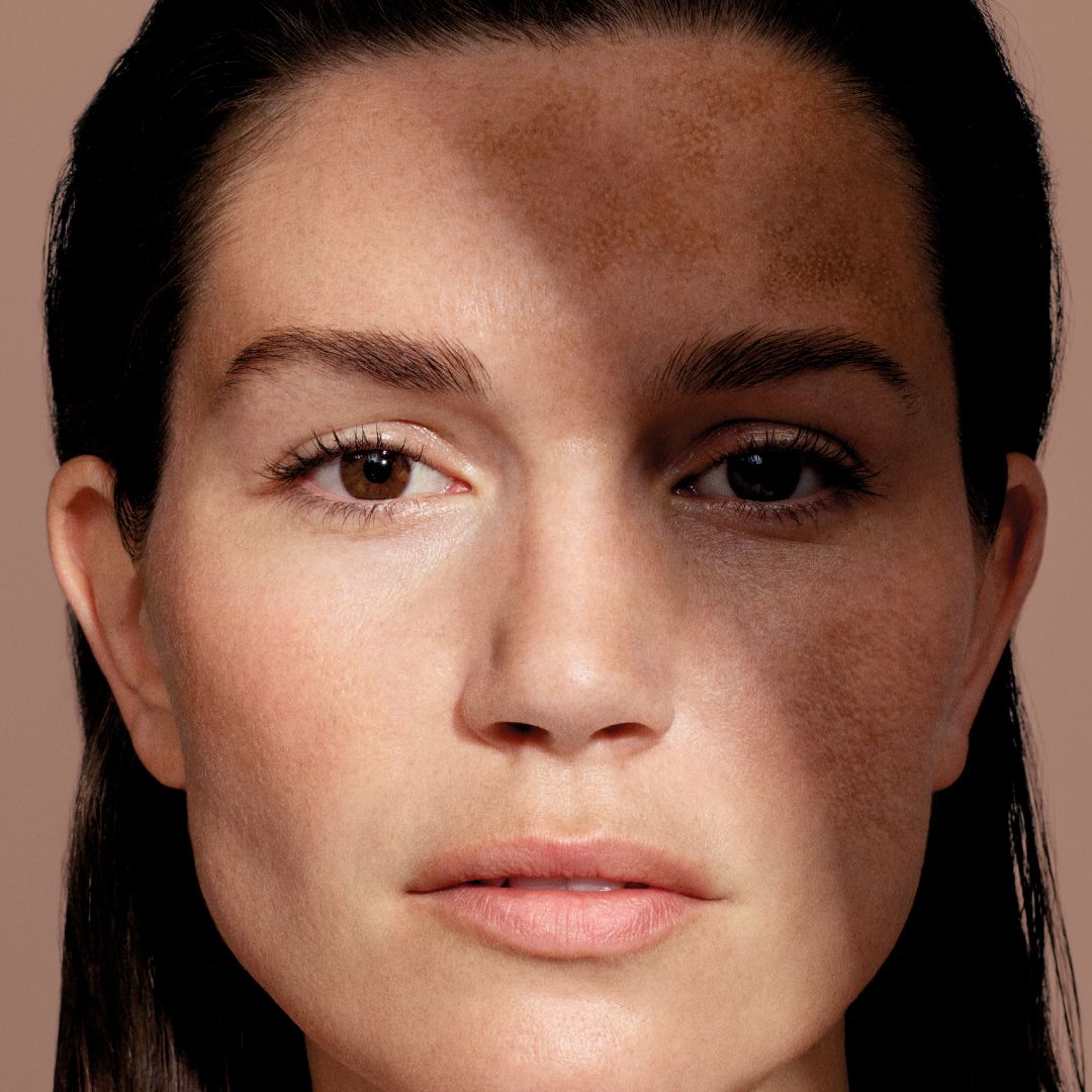 Mesoestetic
