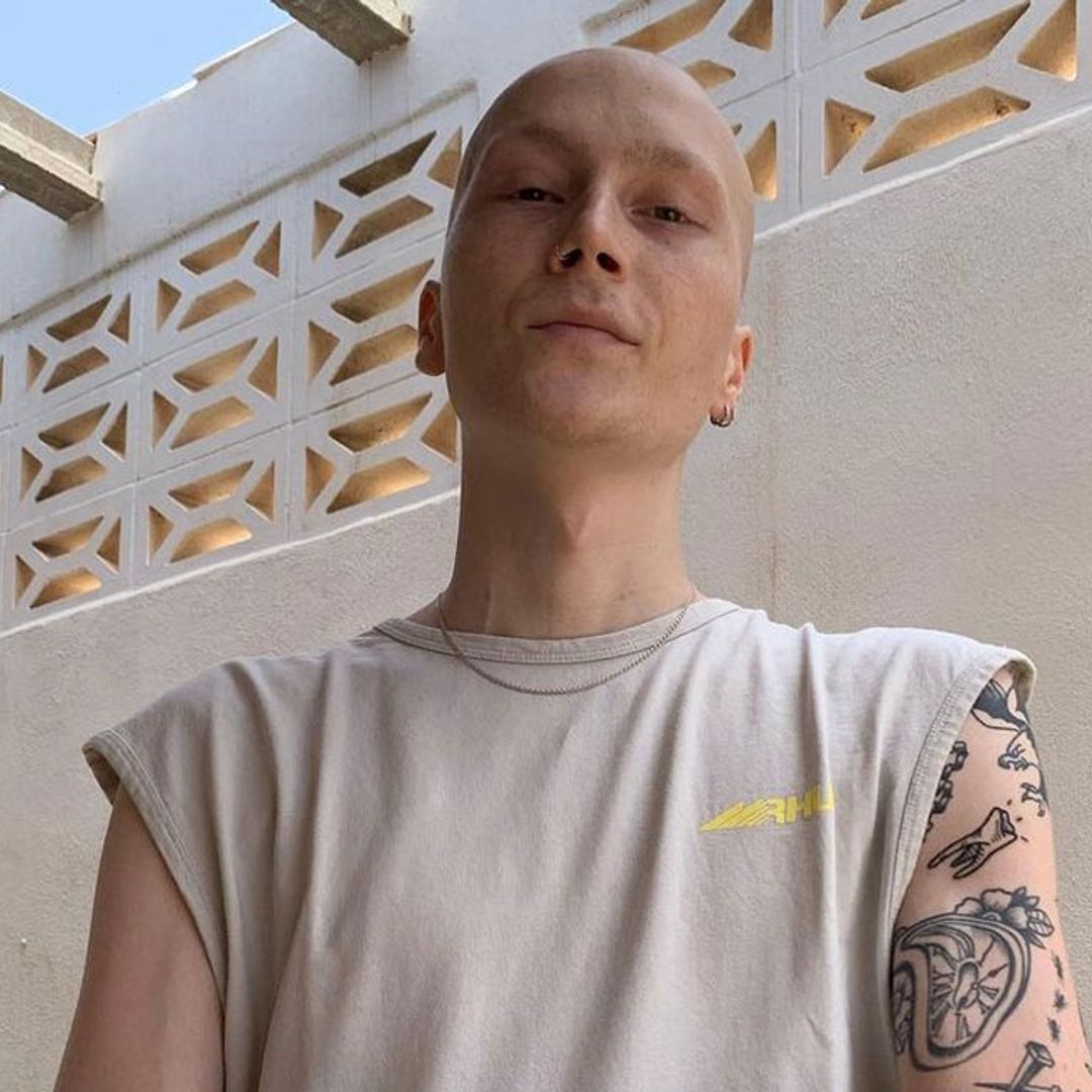 Muere Charlie, el 'influencer' de 20 años enfermo de cáncer