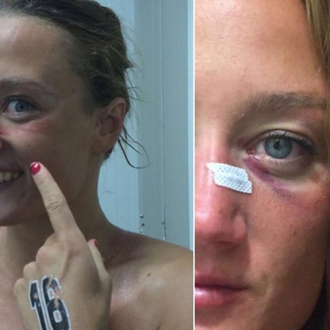 Estalla la polémica por la supuesta agresión a Mireia Belmonte denunciada por su novio