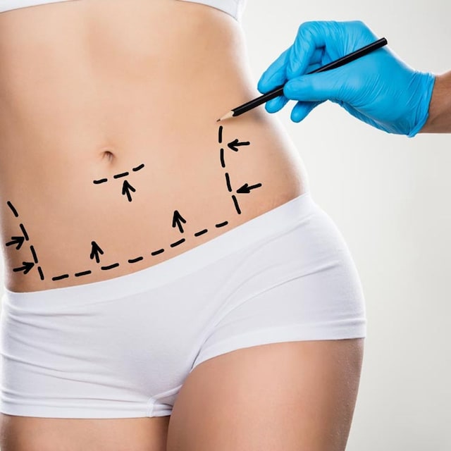 abdomen 2t