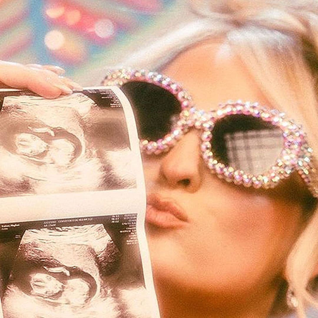 ¡La familia vuelve a crecer! Meghan Trainor anuncia que está embarazada de su segundo hijo