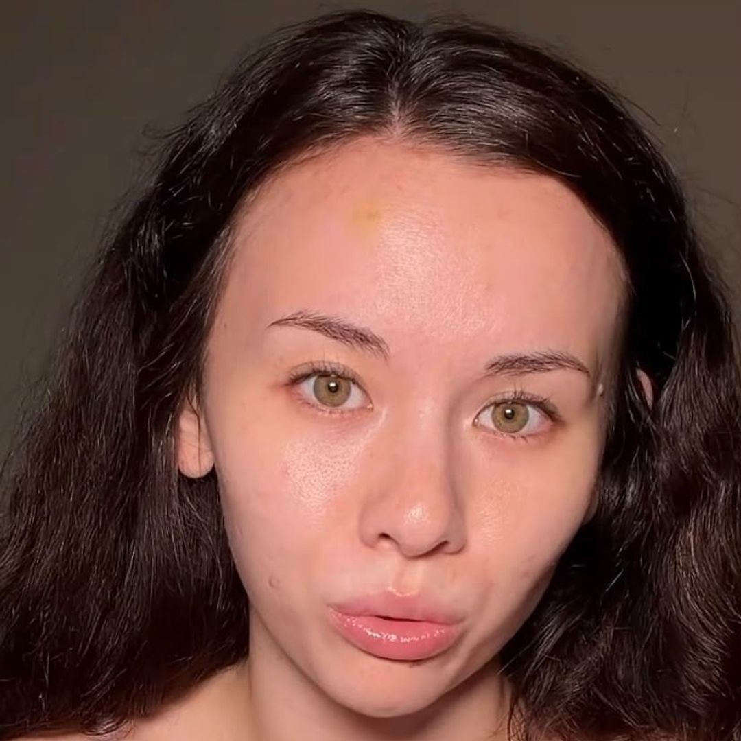 Brutal agresión en plena calle a la influencer María Reus Huang, que acaba en el hospital y muestra lesiones