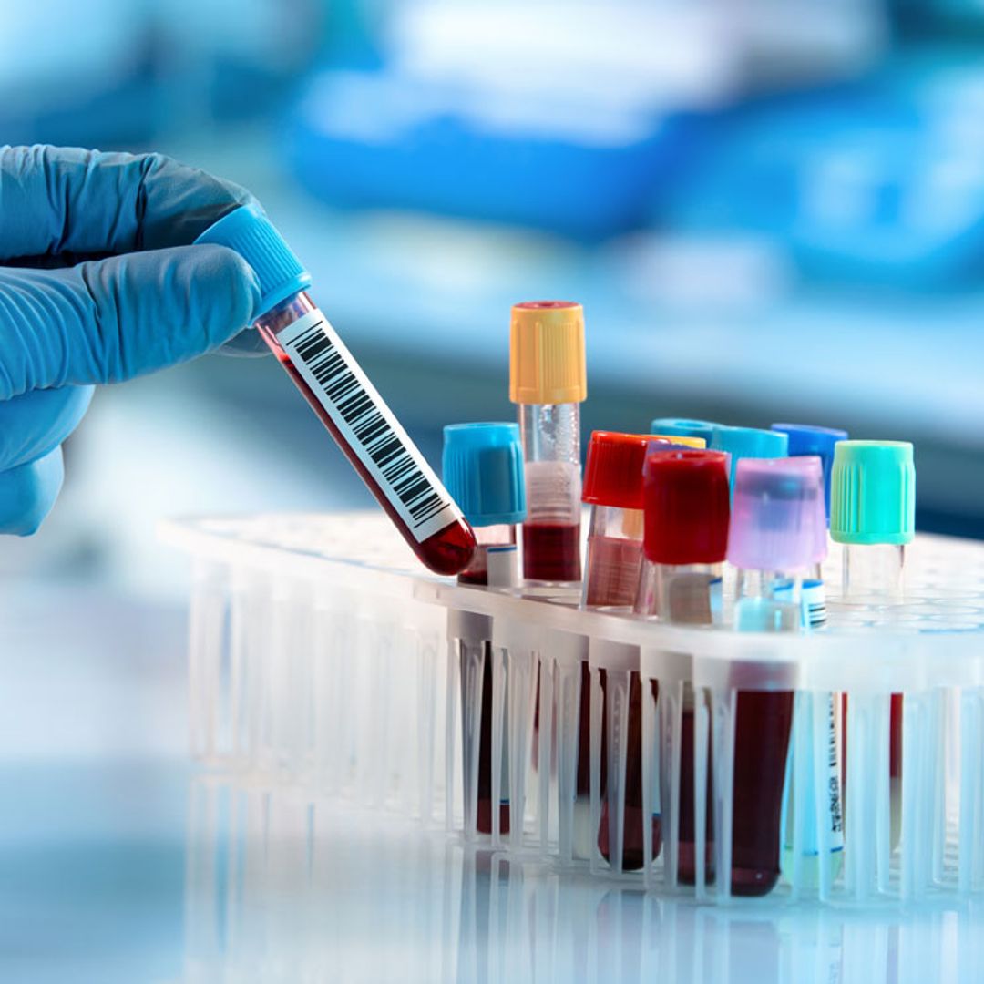 Cáncer linfático: tipos, síntomas y diagnóstico precoz