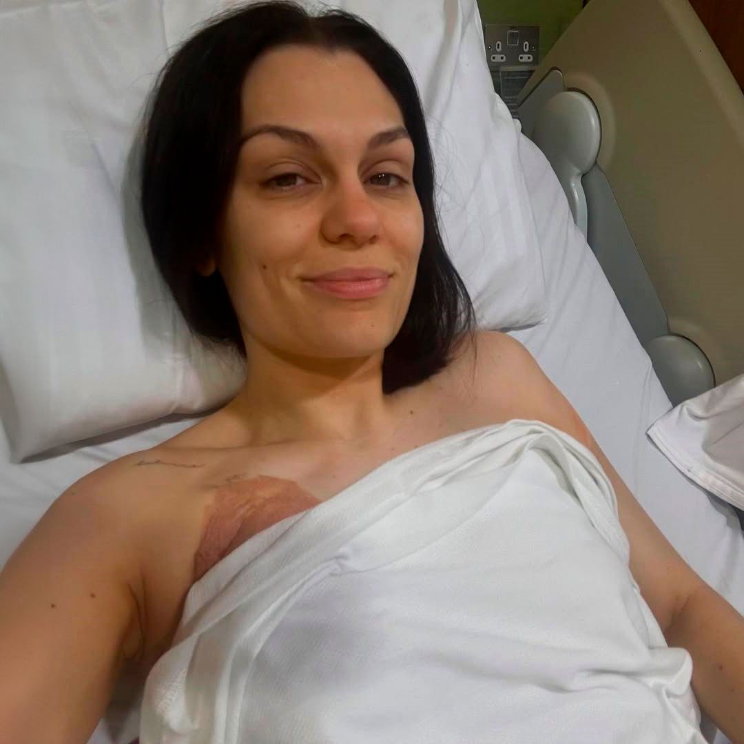 Jessie J, hospitalizada de urgencia tras su operación por cáncer de mama: “No es una recuperación rápida”