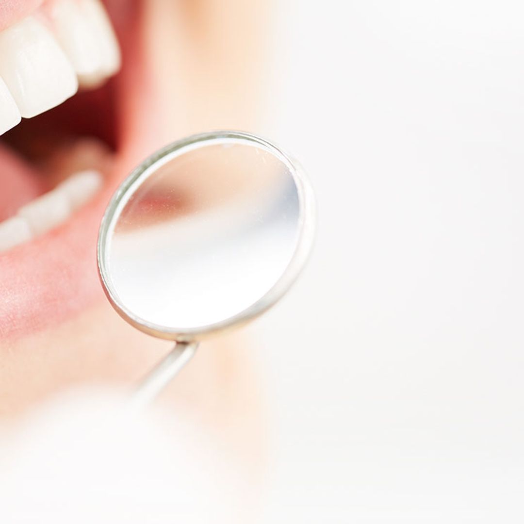 Así afecta tu alimentación a la salud de tus dientes