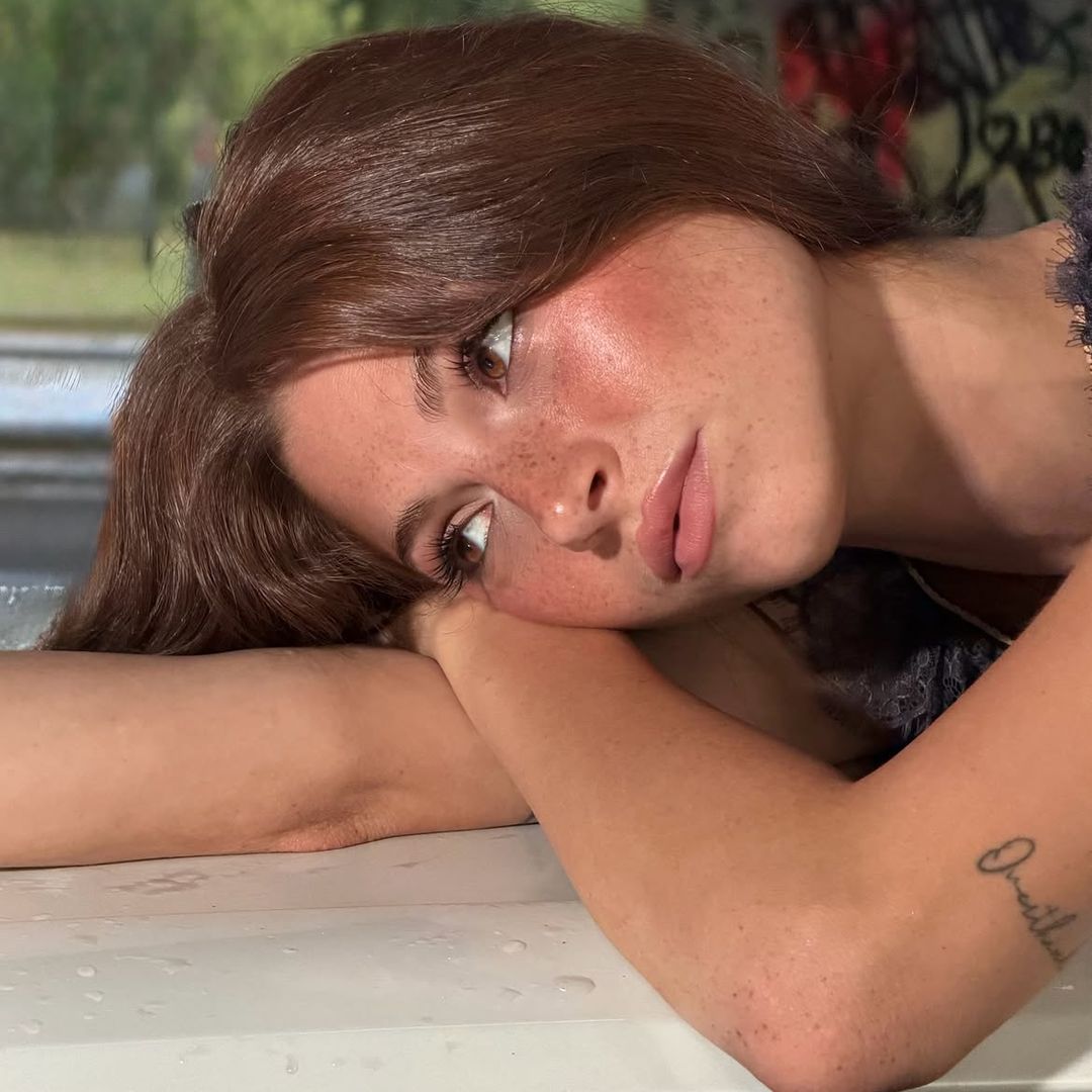 Dra. Natalia Jiménez, dermatóloga: "Para prevenir los brotes de eccema del próximo invierno es clave anticiparse y mantener la hidratación intensa todo el año"