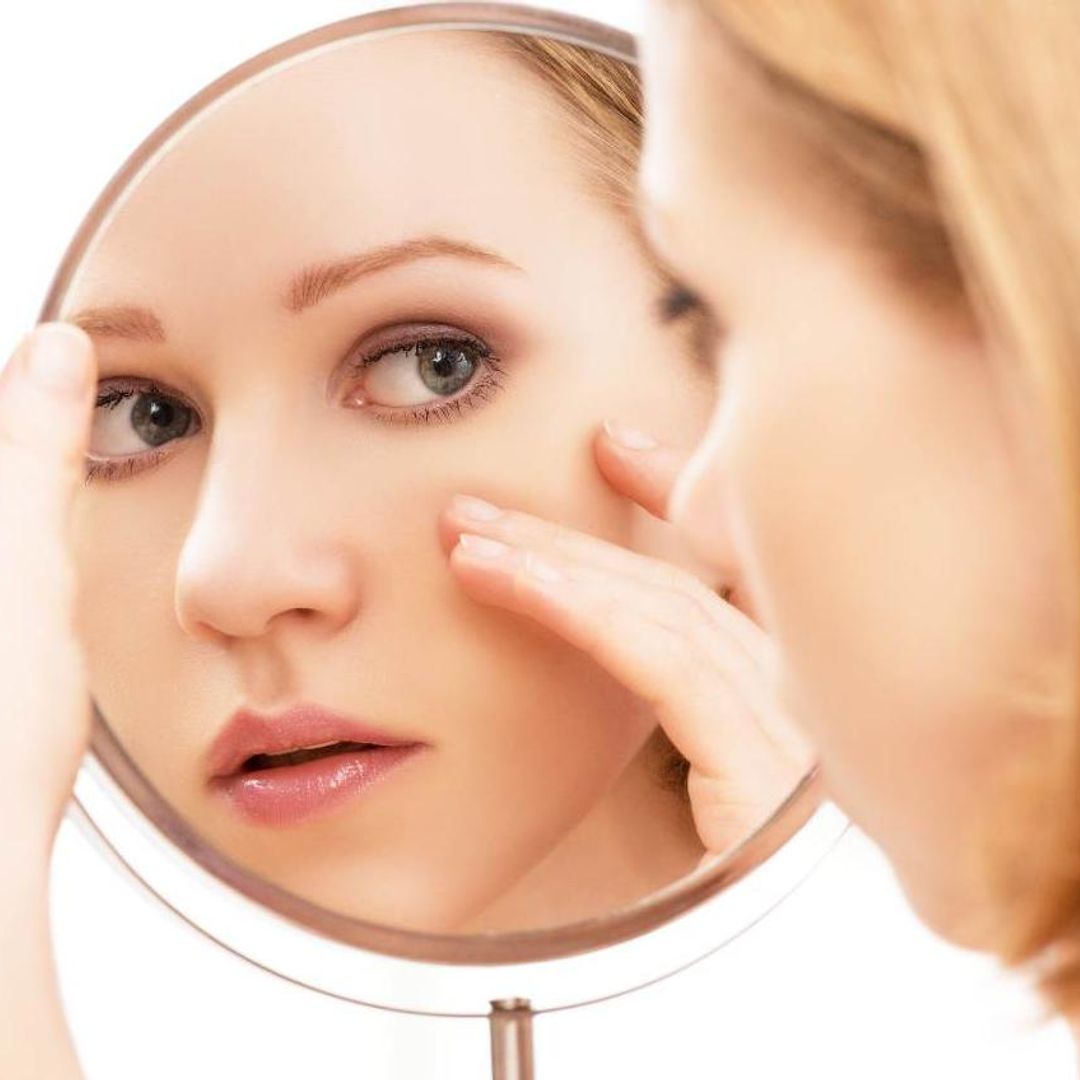 ¿Bolsas en los ojos? Estos son los trucos naturales para eliminarlos