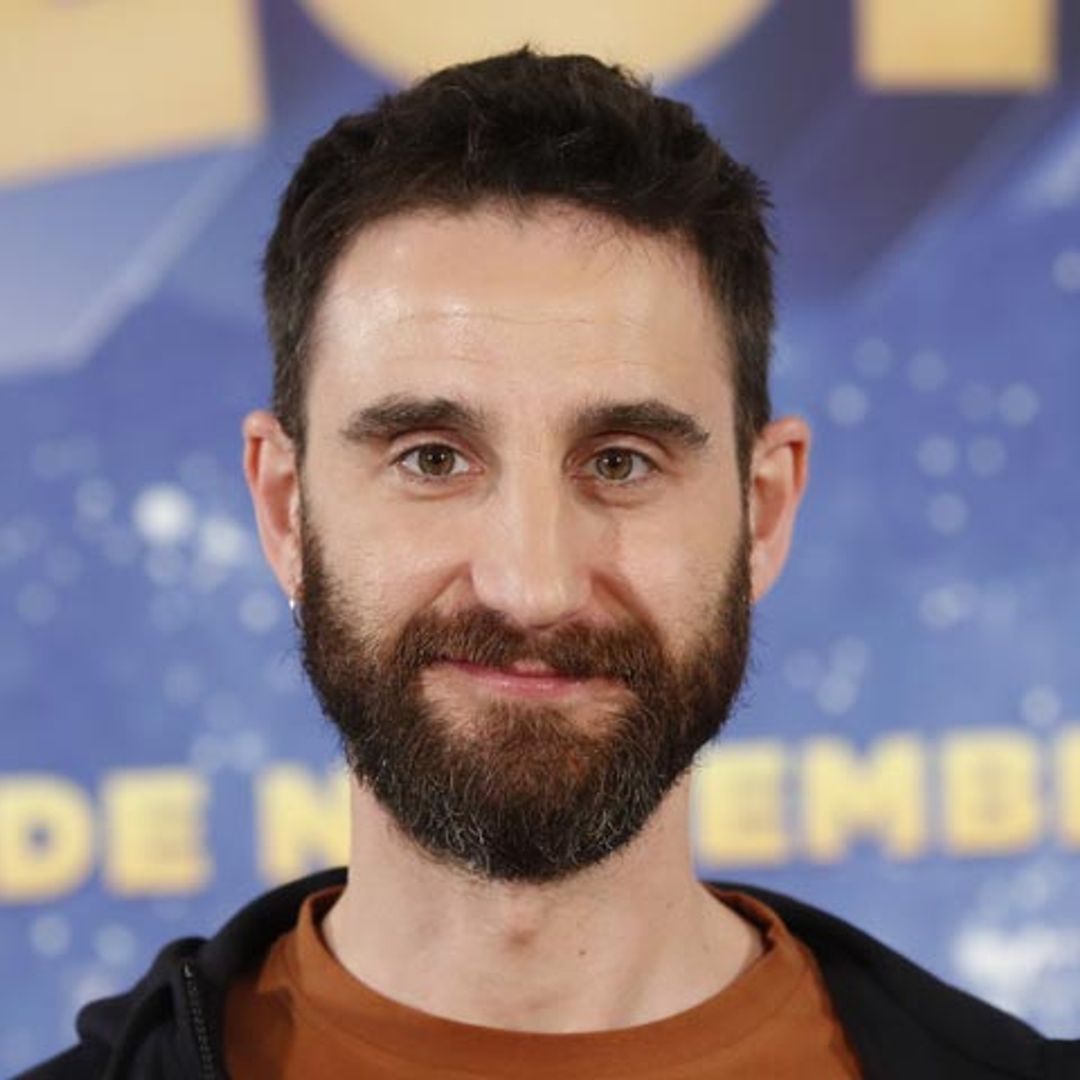 Dani Rovira muestra las secuelas físicas que le ha dejado el rodaje de 'Superlópez'