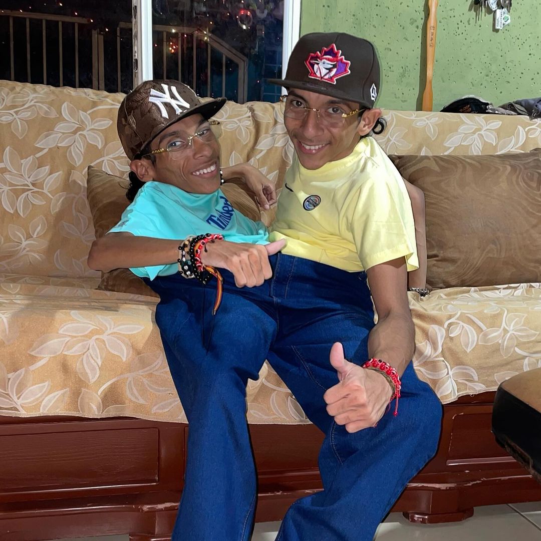 El último adiós a José Luis y José Armando, los hermanos siameses que conmovieron al mundo: así ha sido su emotivo funeral en Ecuador