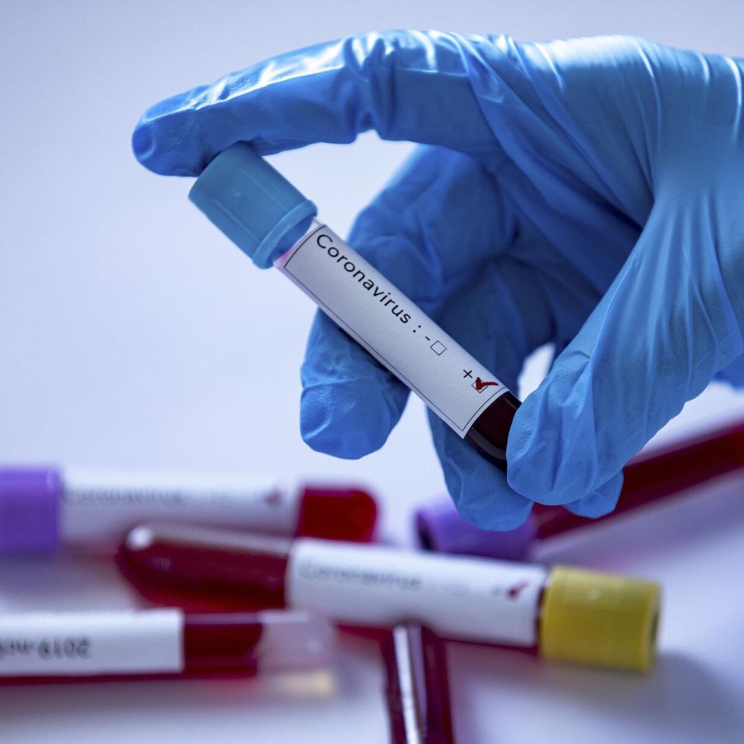La realeza enfrenta su primera pérdia por Coronavirus
