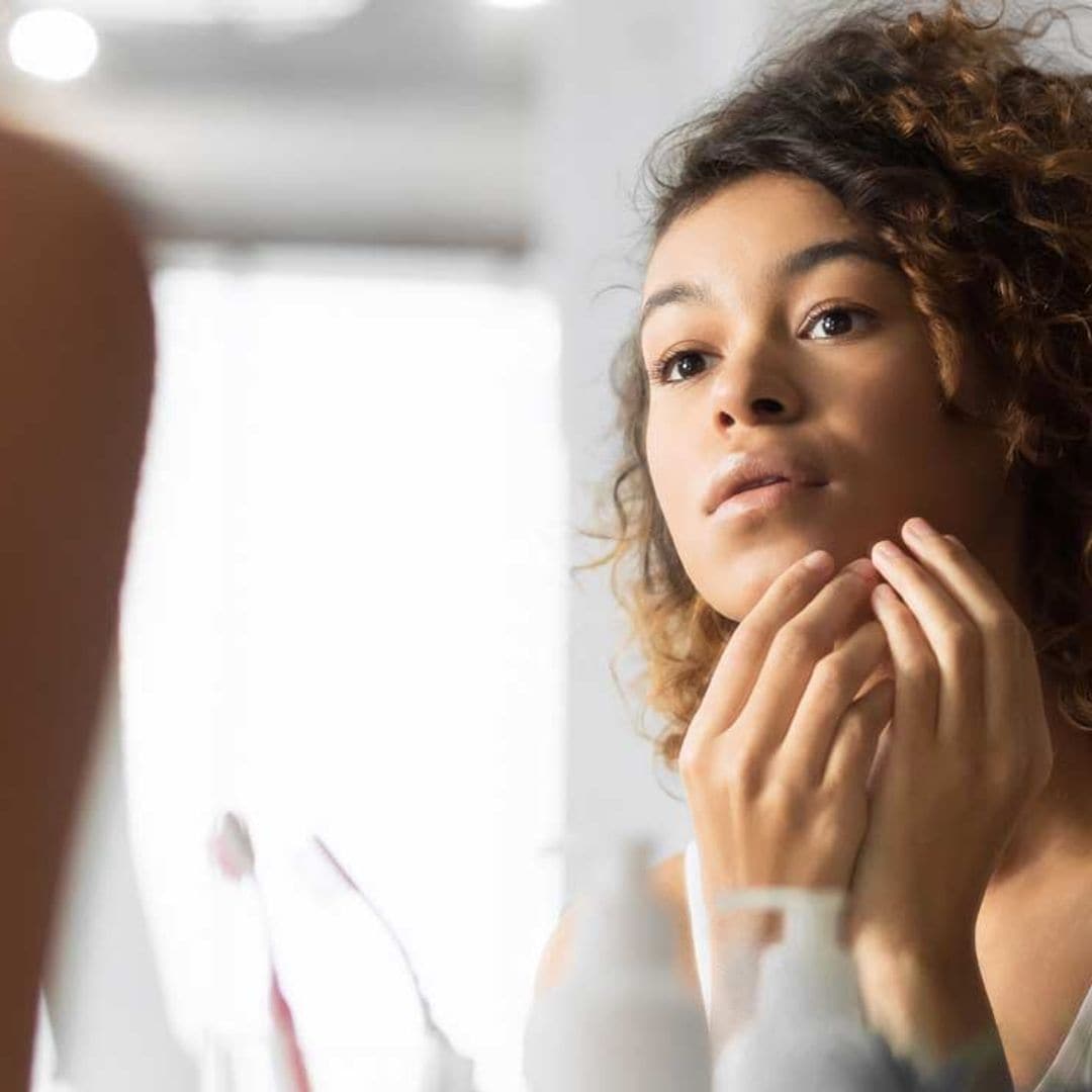 ¿Por qué salen granos cuando se tiene la menstruación?