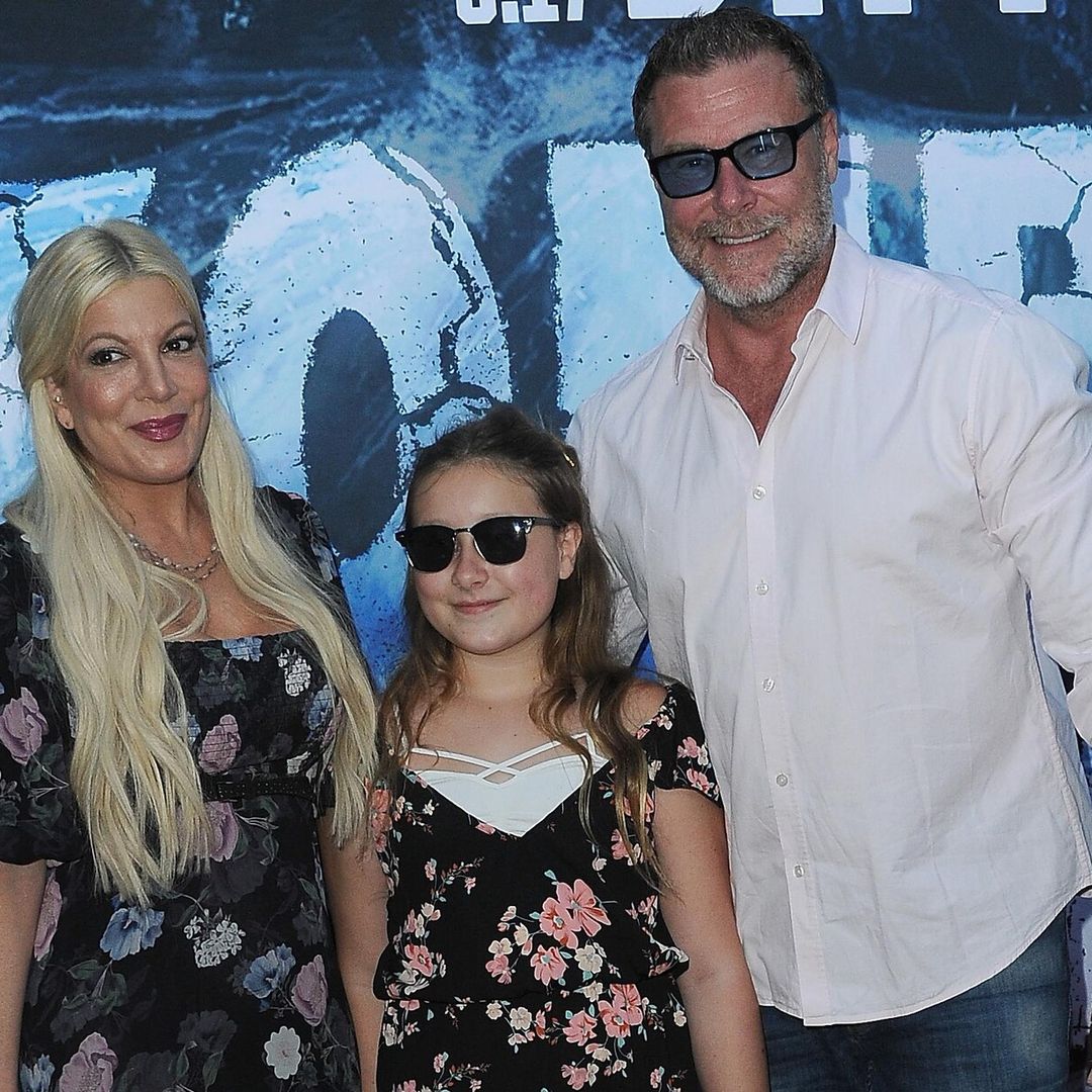Qué es la migraña hemipléjica, la enfermedad que padece Stella, la hija de 14 años de Tori Spelling