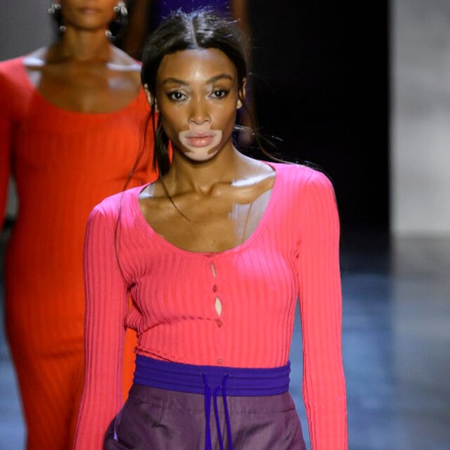 winnie harlow