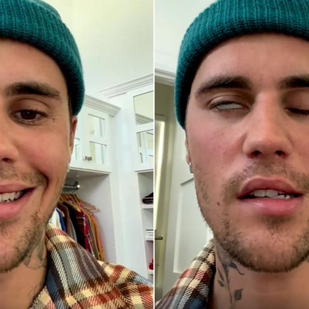 Las imágenes de la parálisis facial de Justin Bieber que le ha obligado a cancelar sus conciertos