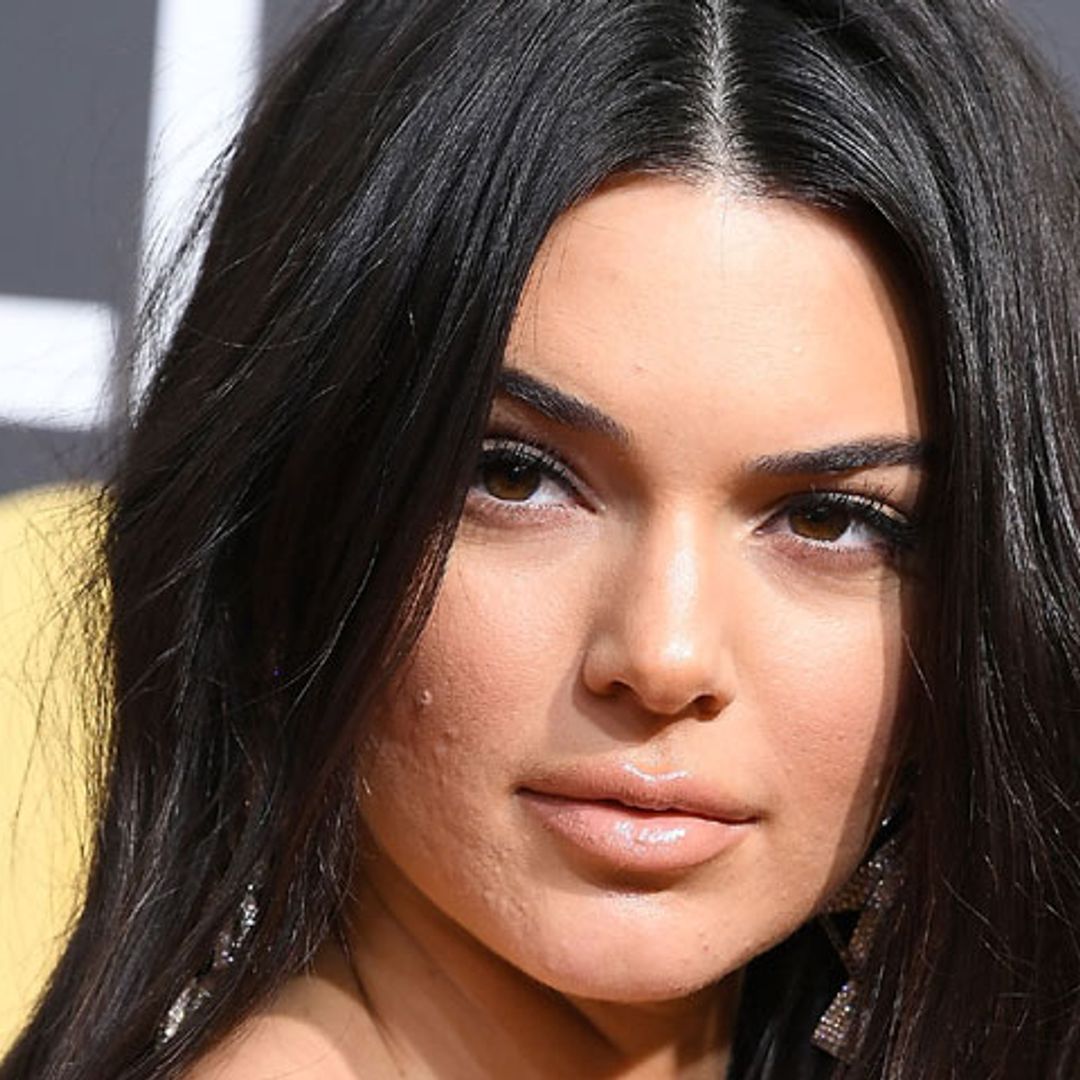 ¿Qué puedes hacer si tienes un brote de acné como el de Kendall Jenner?
