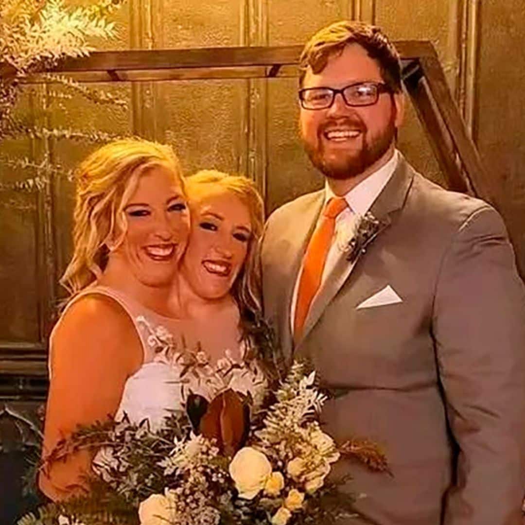 La boda de la gemela siamesa Abby Hensel con el veterano del ejercito Josh Bowling y su historia de superación que conmueve al mundo