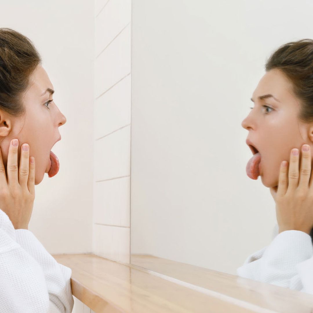 ¿Qué es la 'lengua COVID-19' y cuáles son los síntomas?