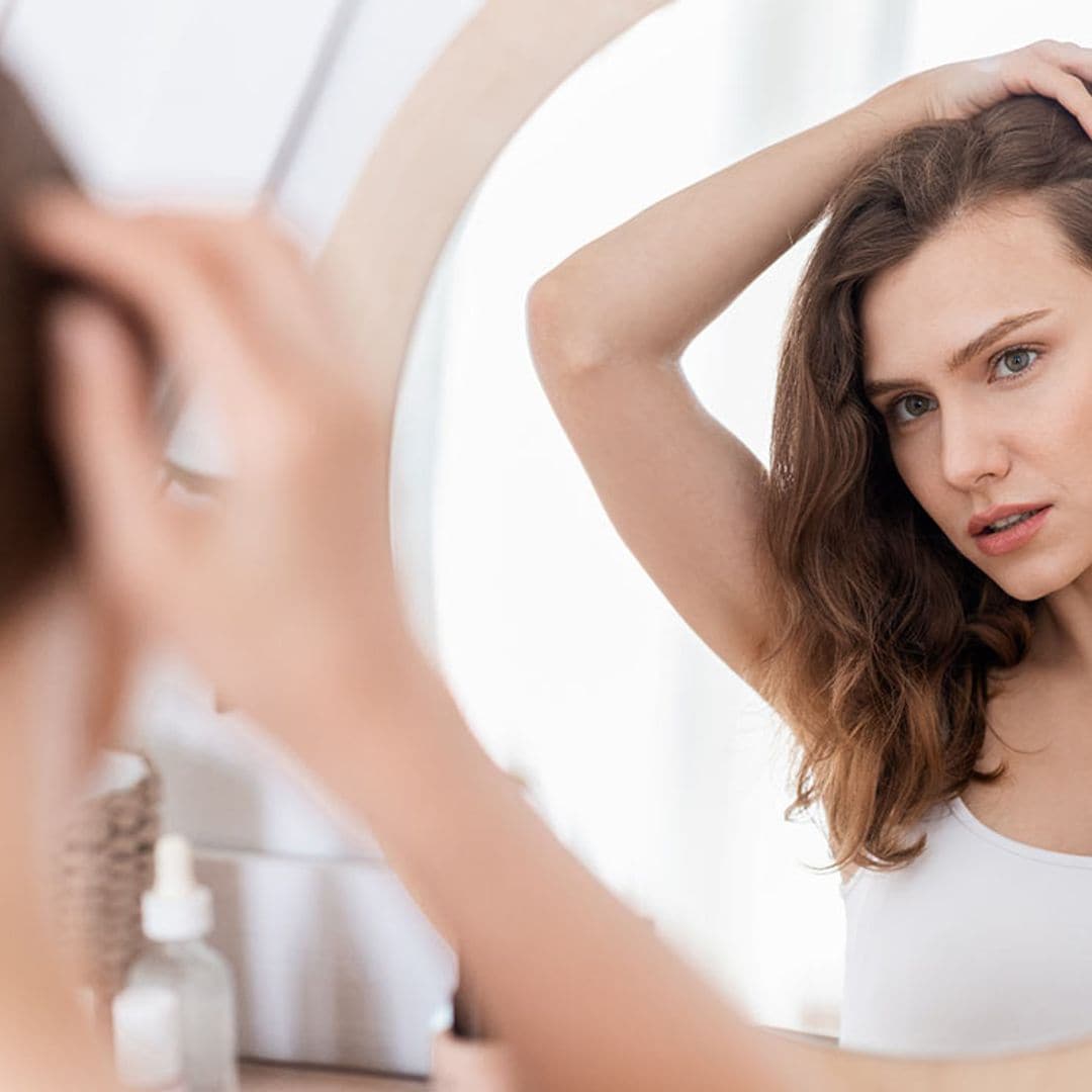 ¿Puede tener la psoriasis relación con la caída del cabello?
