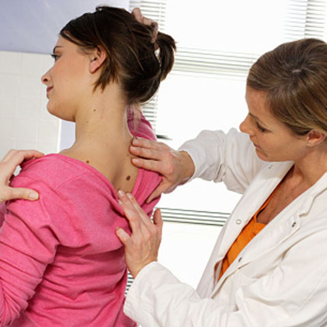 Melanoma: cuando la piel no perdona ni olvida