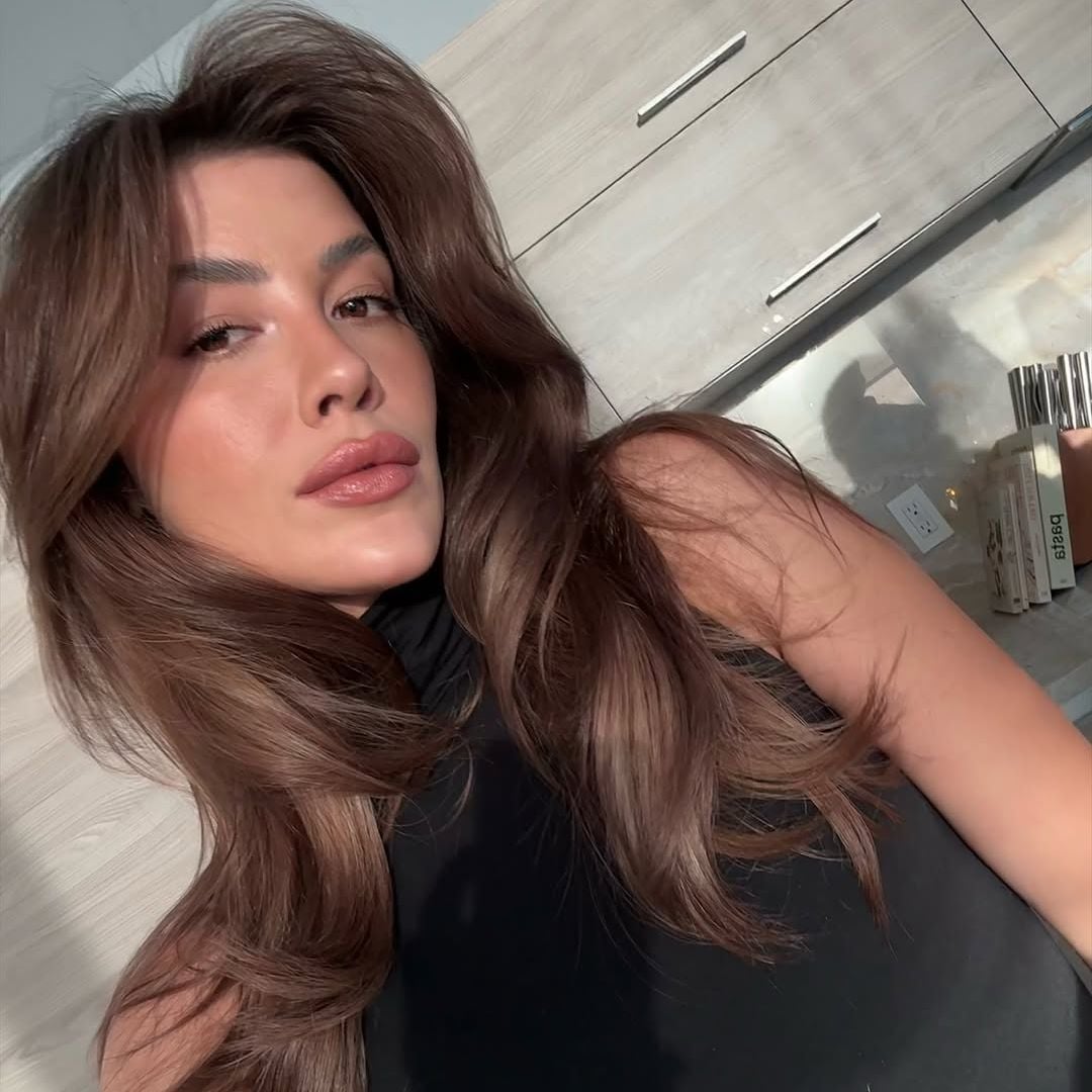 Michelle Salas se sincera sobre la condición que padece en la piel: 'Ha sido súper frustrante'