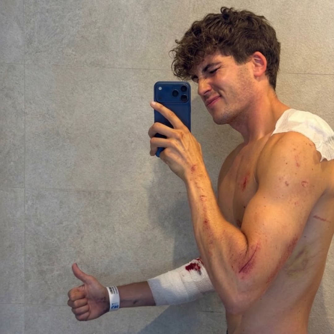 El dramático accidente del influencer Javier Gallardo en Madrid tras ser perseguido por otro motorista: "Tuve miedo de verdad"