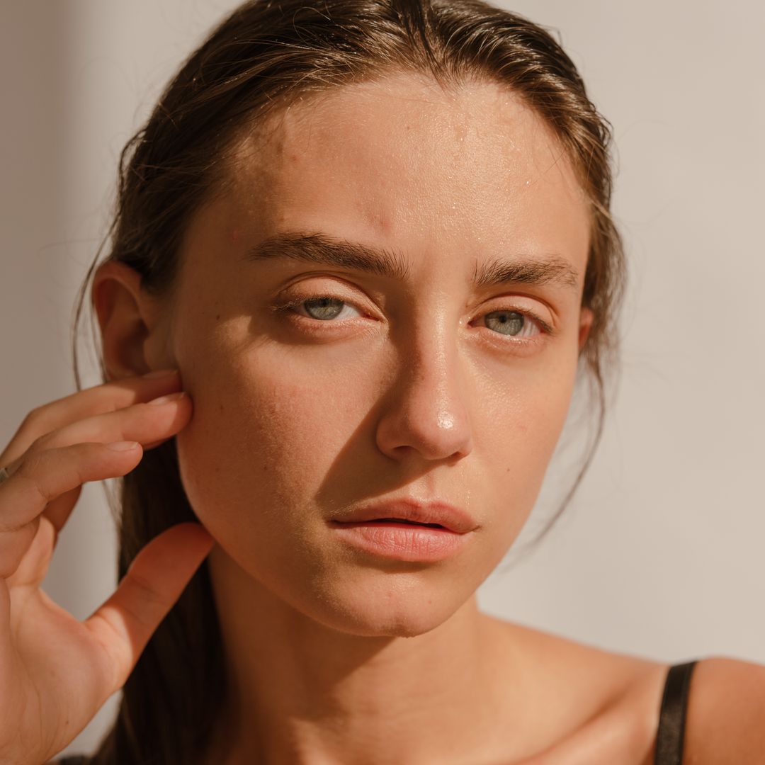 Cómo eliminar el melasma definitivamente: las 7 cremas más eficientes según los expertos